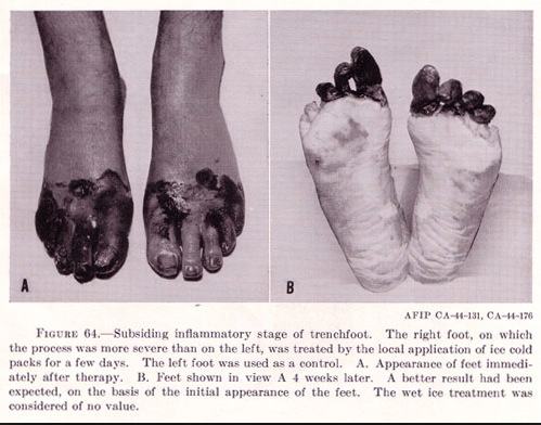 archibald_weber's tweet photo. My friend @moveslikejager3 just mailed me a pic of what his feet look like! My boy is in need of a pedicure! #Trench https://t.co/WHD0Sc2Ro6