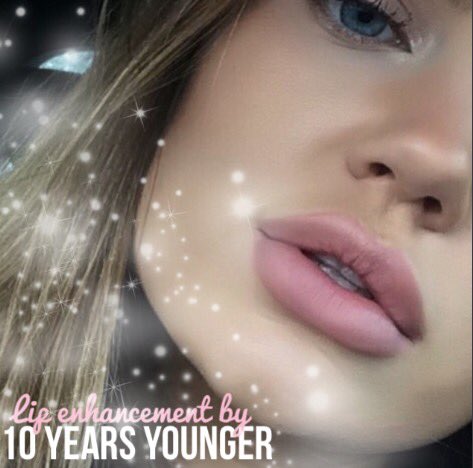 Client selfie ✨ lip enhancement by <a href="/10yearsyoungerr/">10 YEARS YOUNGER</a> 💉💋🇬🇧 #lip fillers #juvederm #JennerUpdates #makeup #love