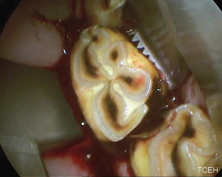 n_townsend79's tweet photo. Extracted a displaced and rotated 410 in a donkey with multiple diastemata today #equinedentistry https://t.co/9BF5cQltpo