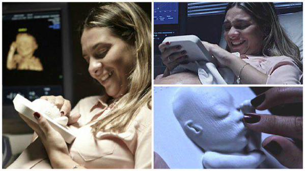 Daily_Funniest's tweet photo. 3D ultrasound printed out for blind mother. This is amazing https://t.co/oalDYmSLBz