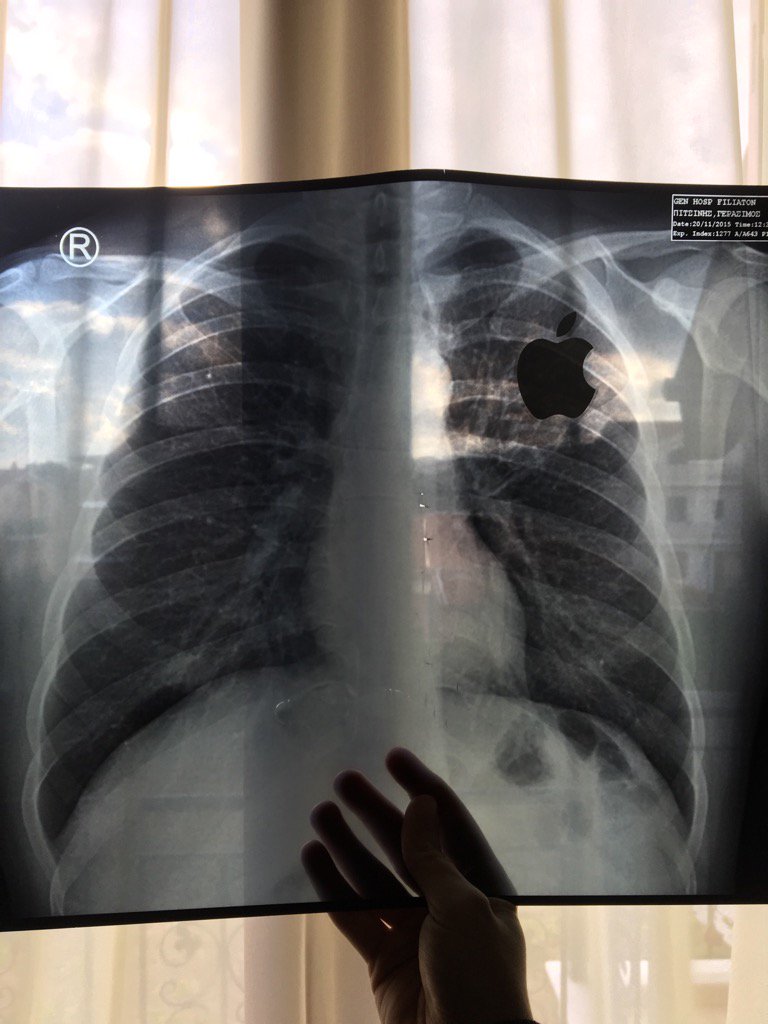 pitsinism's tweet image. Το εντόπισα το πρόβλημα.
#Apple #AppleFans #AppleGreece