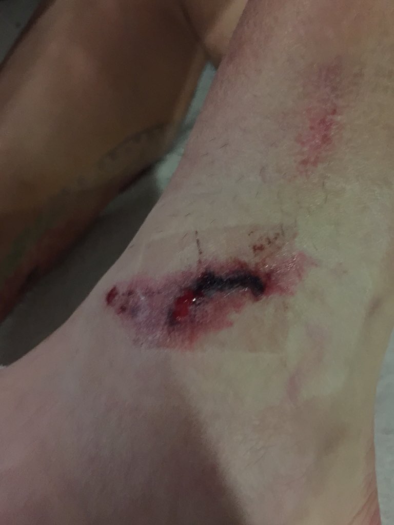 rubenssambueza's tweet photo. Gracias a todos por los mensajes!!!! Ahí vamos recuperándonos 👍👍👍 https://t.co/3Wuw5oUFOm