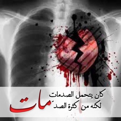 تبا" لشخــــص بحث عن اخطــــائي😔】
وعنــــدما♚ لم👆يجـــدها: يخترعــــا😶🙁