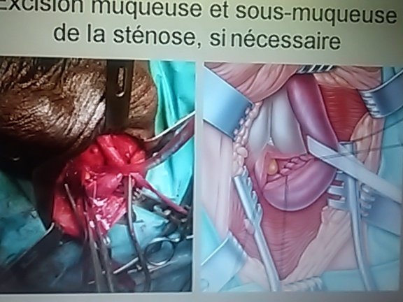 Dr Bernard Boillot (@drboillot) on Twitter photo 