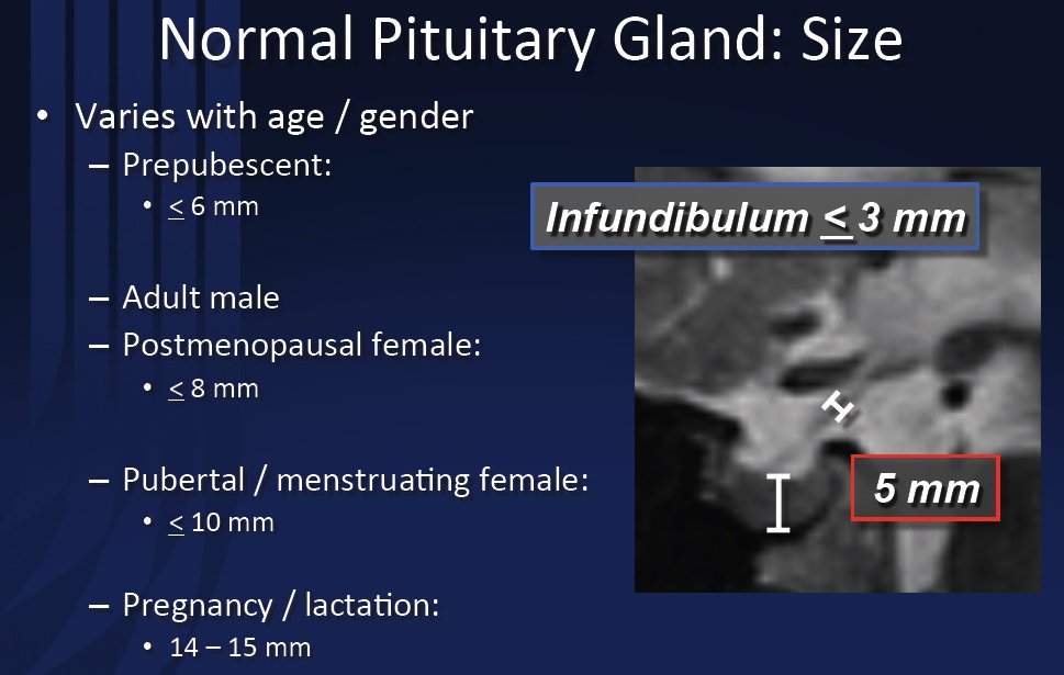 Dr Jenny Hoang On Twitter Normal Range Of Pituitary Gland Size From jb-image-317715-asiachan-kpop-image-board