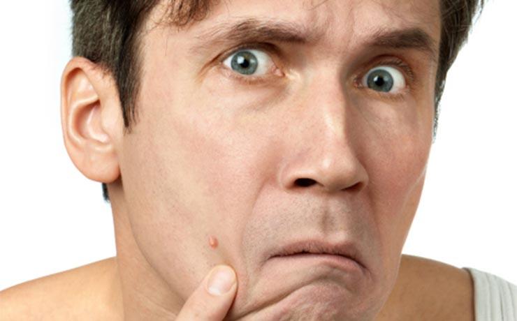 MensHealthMag's tweet photo. 5 reasons you still have acne as a grown-ass man: https://t.co/Ci3fFusUbm https://t.co/lMbfepI0Xi