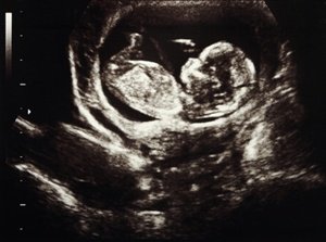PregnancyMag's tweet photo. First trimester is the most important for your baby's heart health:  https://t.co/kEN2FU8ila by @pregnancymag https://t.co/ReKpx4Gap3