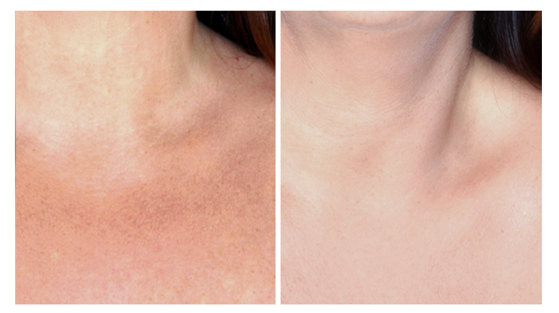 Avivieclinic's tweet photo. #Avivie #before #cream #хорошаякожа #skin #nowrinkle #nowrinkles #deadsea #deadseacosmetics #peptedescomplex https://t.co/AQAo9qdVKr