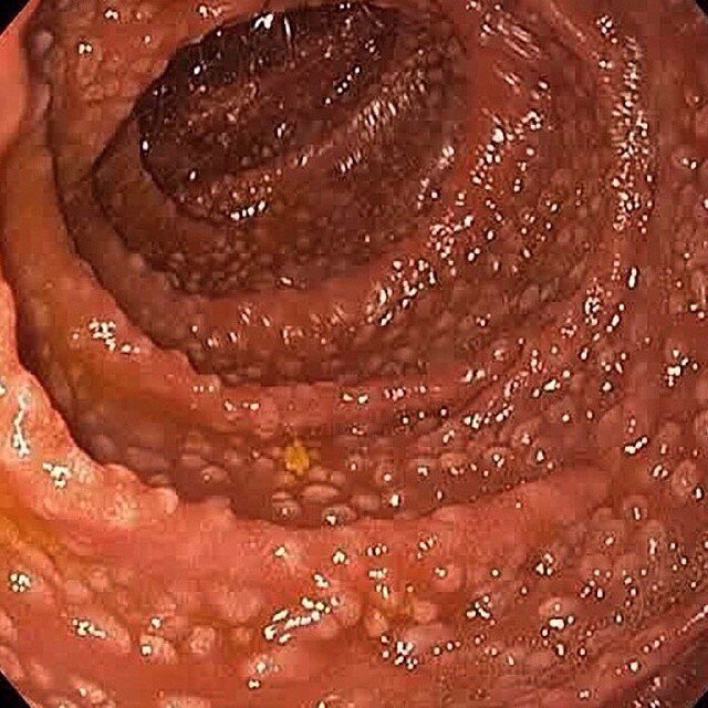 mosaiced_'s tweet photo. #medstudent #medschool #foamed #usmle https://t.co/mlAPLDgjJ8