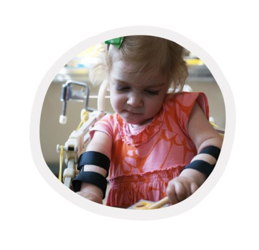 MagicArmsUS's tweet photo. #MagicArms can empower kids to draw, play with their toys and hug the people they love: https://t.co/CD7SGmFEe3 https://t.co/mOhi97glkF