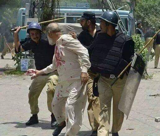 Afghanupdatess's tweet photo. One picture thousands words
An elderly #Pashtoon Man beating by #Pakistani #Police
#Pashtoonvoice
#BachaKhanattack https://t.co/QOPnP8VeQV
