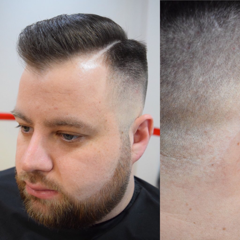 thefiltonbarber's tweet photo. As tight as you can #Skinfade &amp; #Beard styled with @Hairbond #texturiser spray, #Distorter @MenrockHello beard balm https://t.co/mvoXwCiqri