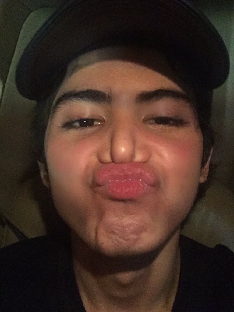 Aduh tiba2 idung ga bisa napas