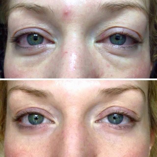 jenny_m_midgley's tweet image. #RodanandFields #multifunctioneyecream #byebyewrinkles #hellobrighteyes jennymidgley.myrandf.com