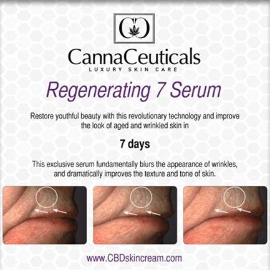CannaCeuticals's tweet photo. Before/After: See results in 7 days with CannaCeuticals - https://t.co/OKVbkppN0M #CannaCeuticals https://t.co/QJsqmry3Kt