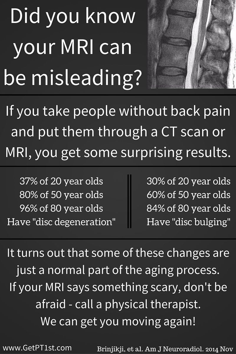 GetPT1st's tweet photo. Did you know your MRI can be misleading? Call a physical therapist to get back to what you love. #GetPT1st https://t.co/vrHcWCOPE8