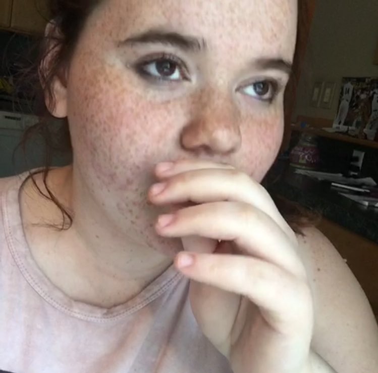 Me in summer omf freckles af