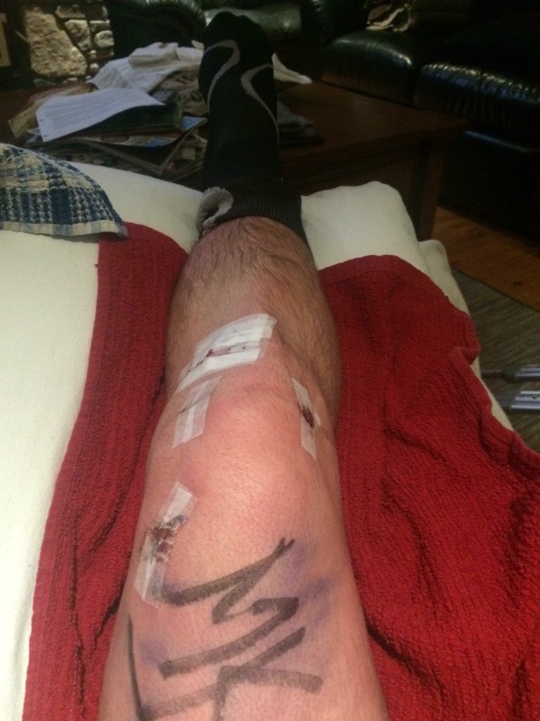 marnoch630's tweet photo. Road to recovery https://t.co/xkmPT4eUDH