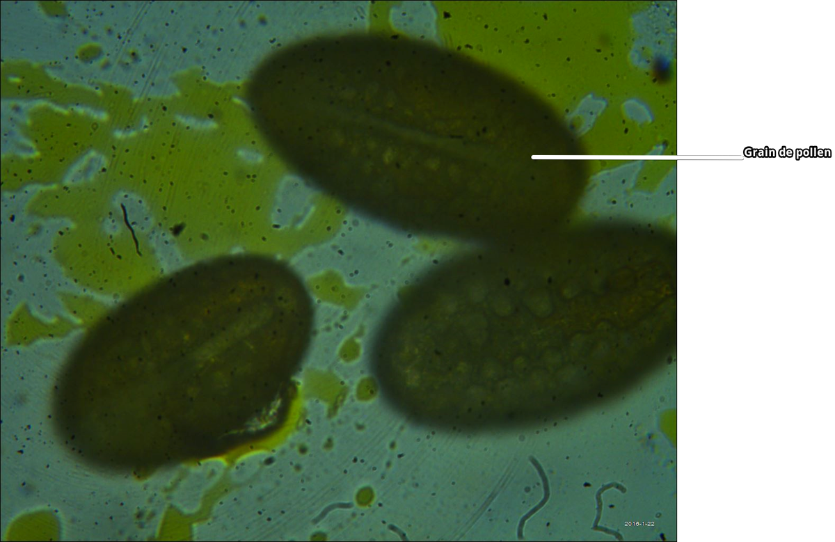 BeaufilsAudrey's tweet photo. Observation d'un grain de pollen de fleur de lys au microscope optique (x400)
#FloraTS2015 #TSbzzz https://t.co/sMTSwaUKva