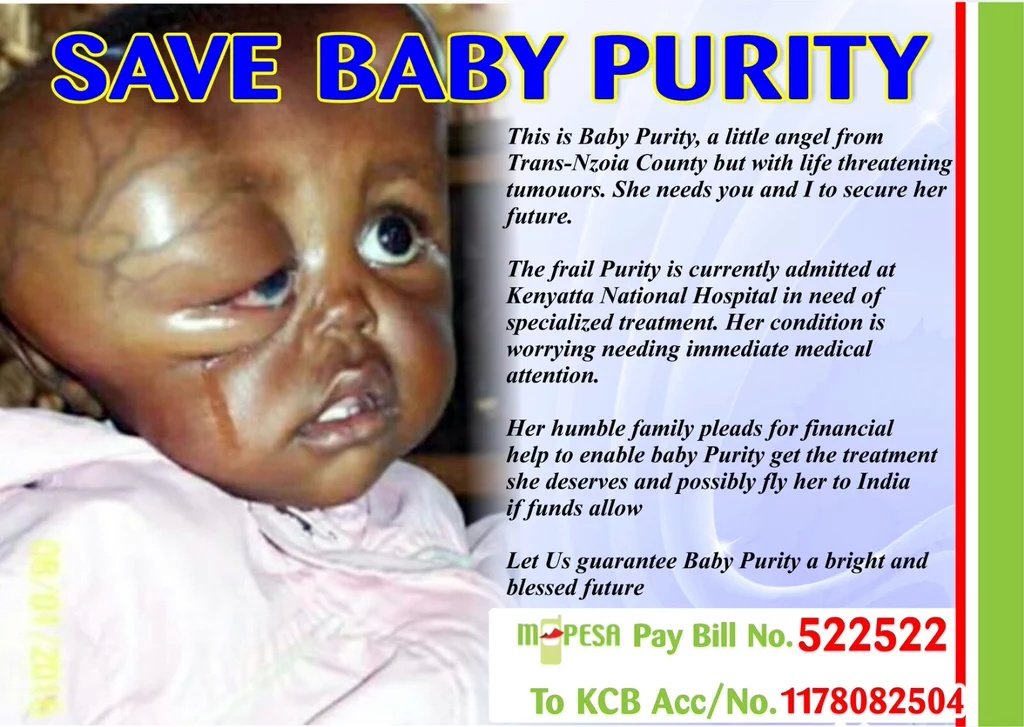Shikohkihika's tweet photo. #HelpBabyPurity . Hopefully she might get her biopsy results today to enable the doctors determine her condition. https://t.co/VQJbWk5qBU