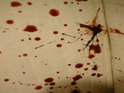 ForensicAccess's tweet image. #Forensic #BPA #bloodpatternanalysis. Supporting #crime investigation &amp;amp; defence #forensics forensic-access.co.uk/blood-pattern-…