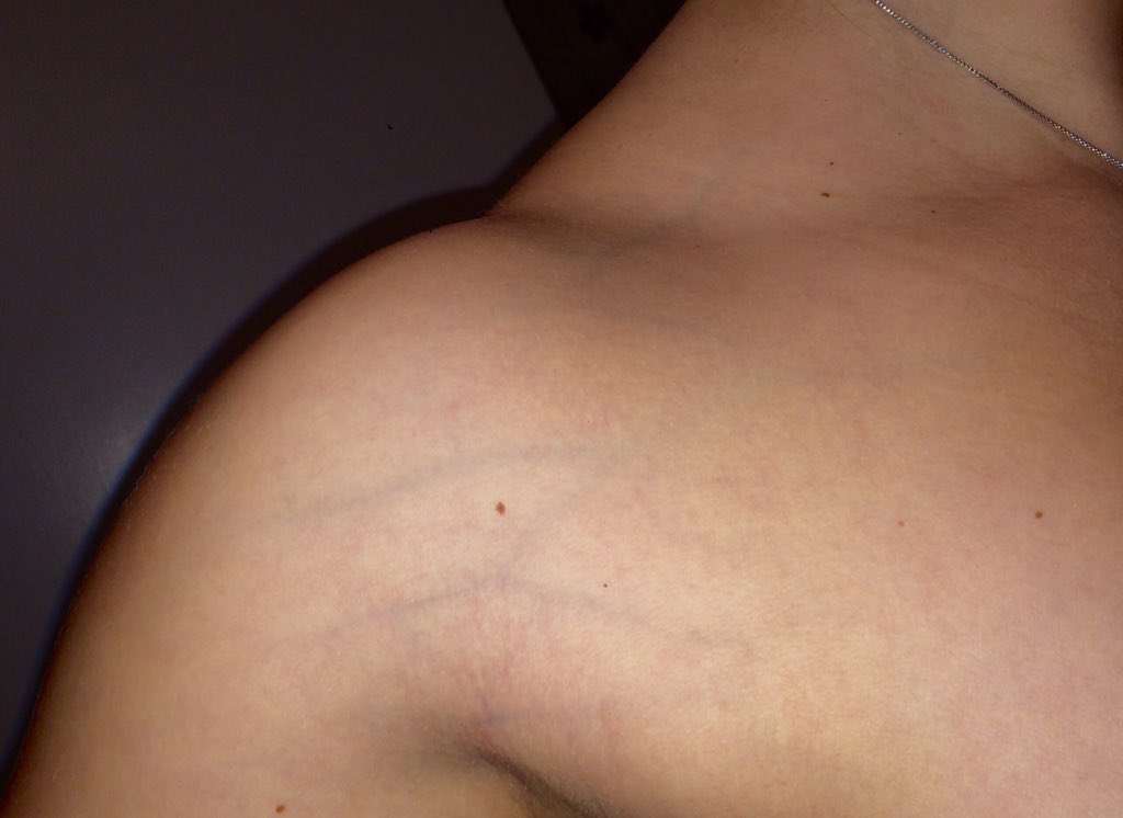 RouteToRipped's tweet image. gainsssssss