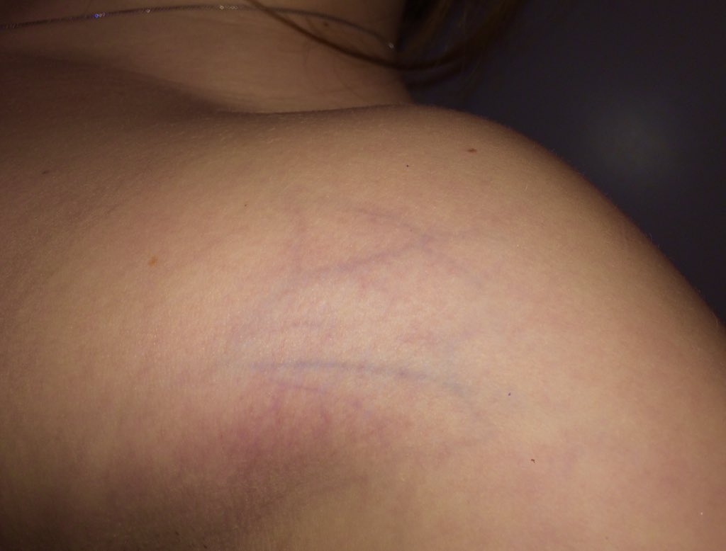 RouteToRipped's tweet image. gainsssssss