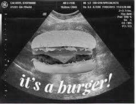 jessburden1's tweet photo. @missgemcollins your pregnancy scan! #CBB #GemmaCollings #TOWIE https://t.co/FMjGHdm6ee