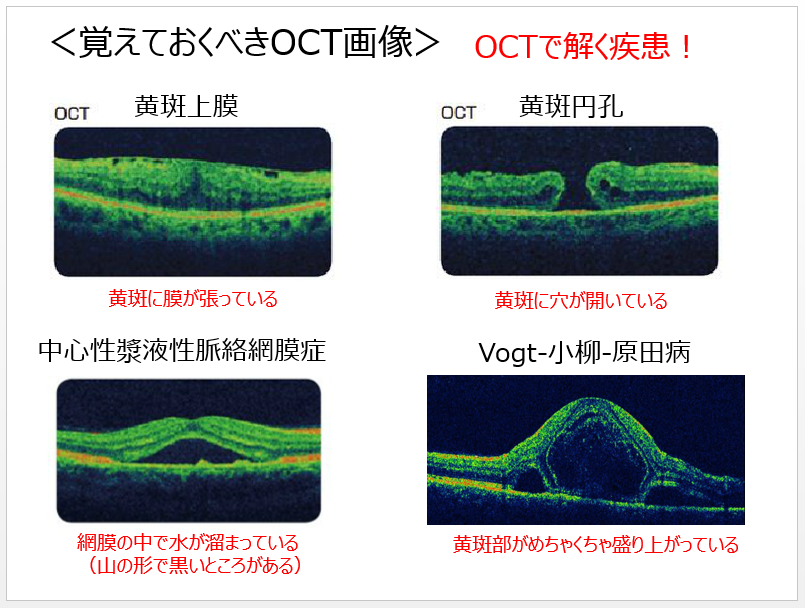 居宅 療養 管理 指導 点数