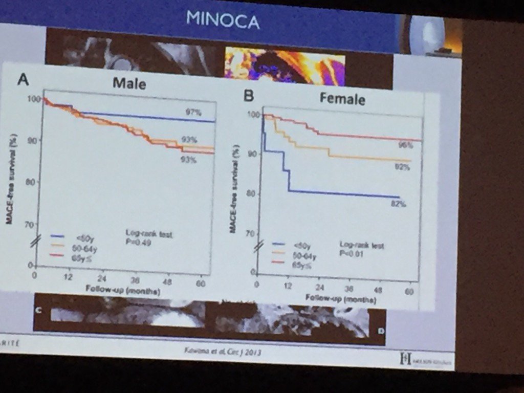 AmitRPatelMD's tweet photo. #MINOCA associated w/ worse outcomes. What is it? Myocardial Infarction No Obstructive Coronary Arteries #scmr2016 https://t.co/MLWXPS1fGh