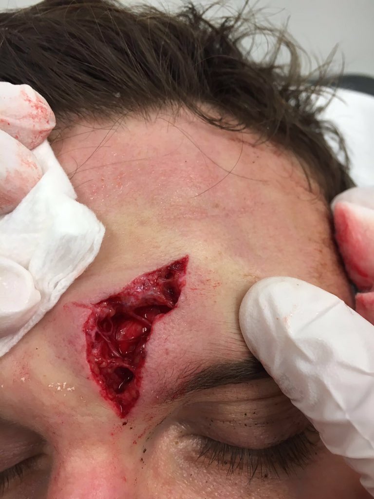 matthew browne tweet media