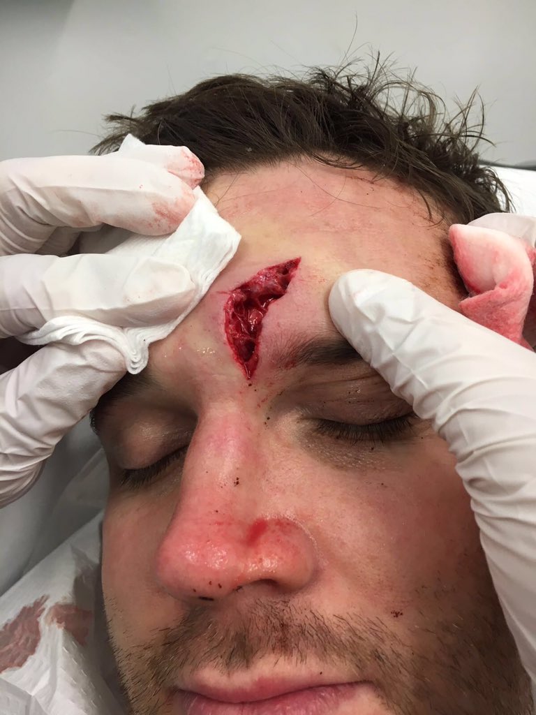 matthew browne tweet media