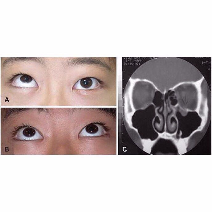 mosaiced_'s tweet photo. #medstudent #medschool #foamed #usmle https://t.co/YMwNTuplgT