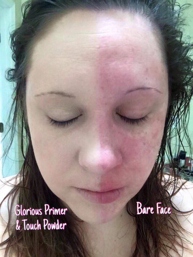 NT_Younique's tweet image. Just look at the difference, great coverage from mineral touch powder. #amazingcoverage #pressedpowder #beauty