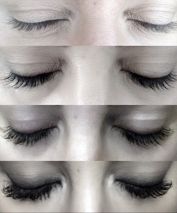 TheDermaClinic's tweet image. New #eyelash #serum @M2beauteIRL amazing results @TheDermaClinic #skinqueen