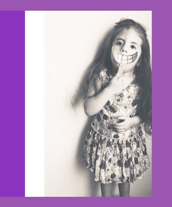 titanela's tweet photo. Sonrisas del corazรณn๐ #sindromedemoebius #smilewithyourheart #MSAD2016 #MoebiusSyndrome #yosonrioporanapaula https://t.co/34SVLSgZam