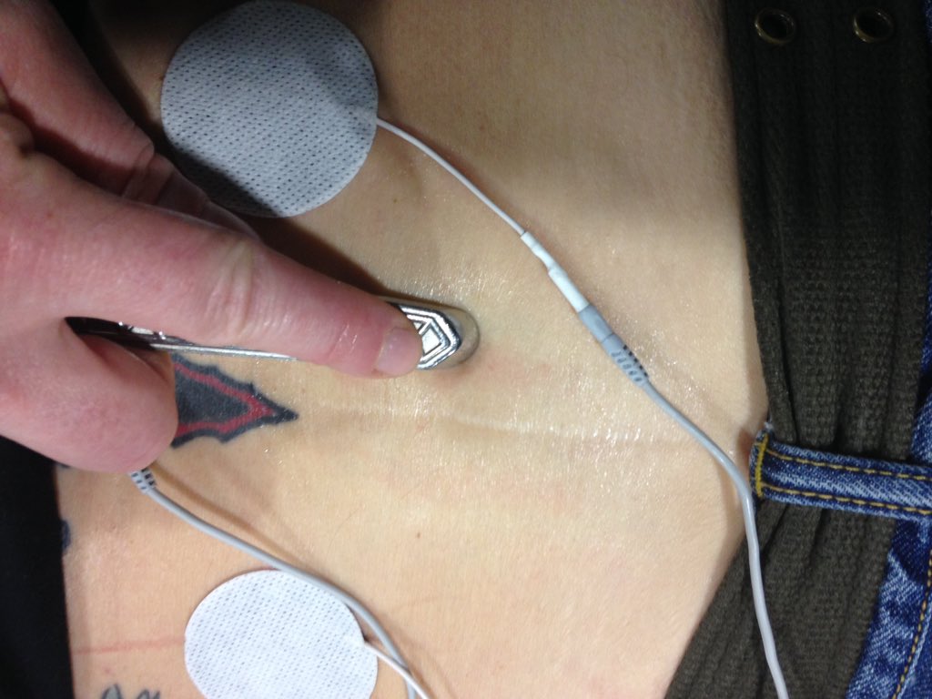 klyons333's tweet photo. @TRP4Warriors breaking up scar tissue in the back. #resiliencyproject #hawkgrips #mwodmarcpro #kcecc https://t.co/xkV2qF9nM0