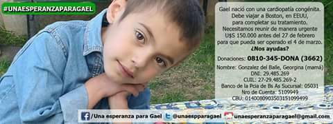 #UnaEsperanzaParaGael Gael nació con una cardiopatía congénita necesita viajar a EE. UU. p/ realizar su tratamiento.