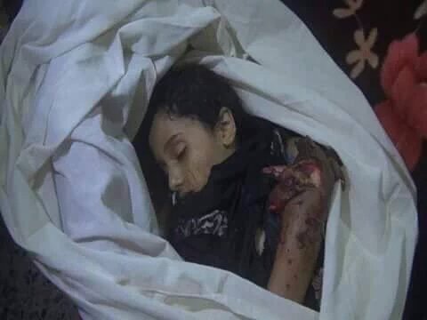 SamYemenyemen's tweet photo. Over 2,000 #children killed by US Saudi-led airstrikes in #Yemen 1000s mothers too #SaudiWarCrimesInYemen  (Graphic) https://t.co/MPcyjvWZJe