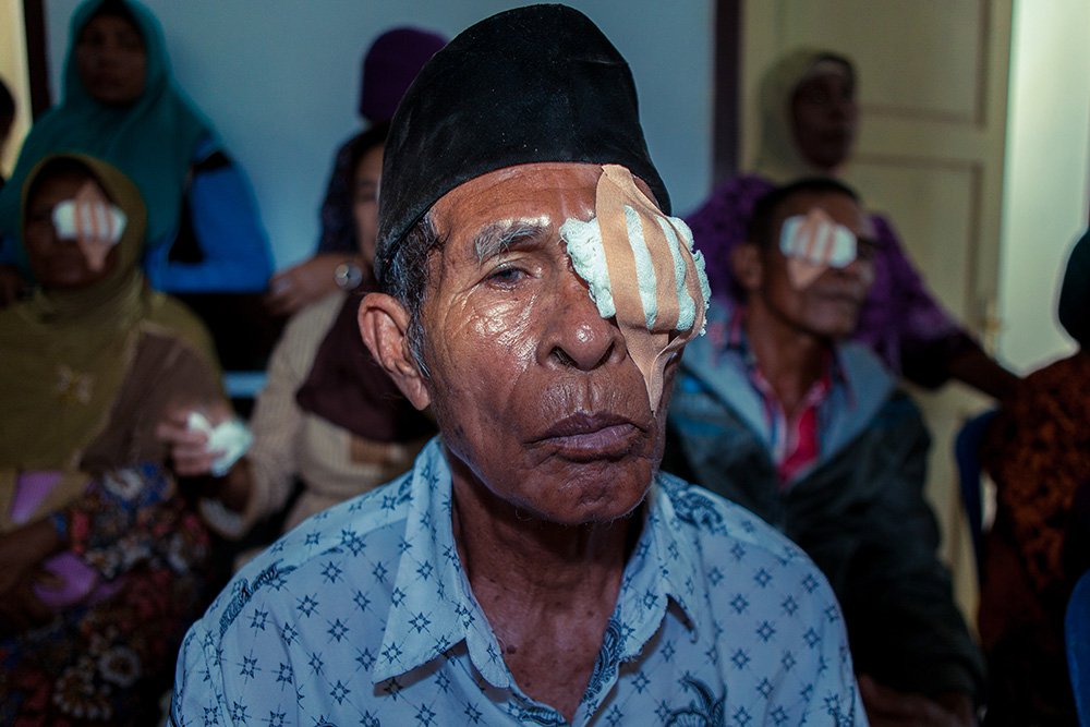ICRC's tweet image. Cataracts are a major cause of blindness in #Indonesia. Hundreds now have better eyesight thanks to free treatment.