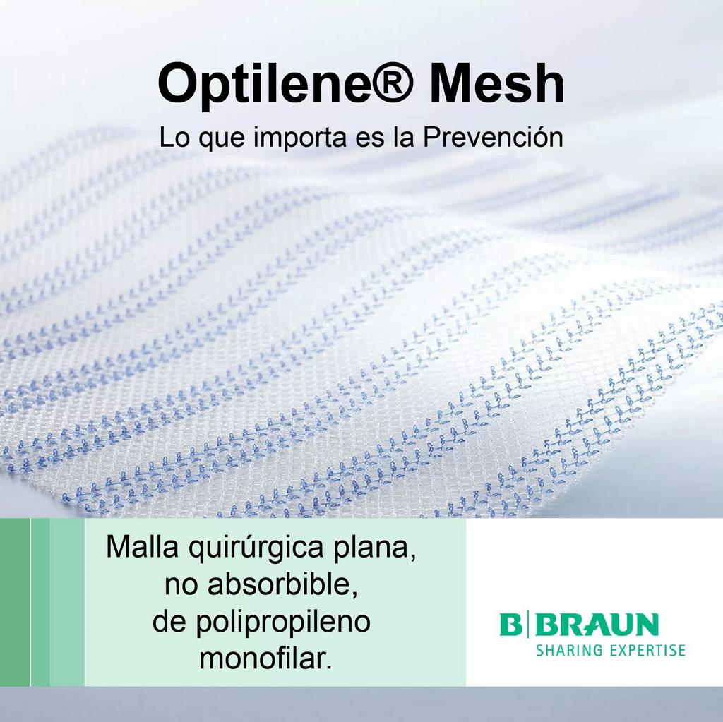 B. Braun Paraguay on X: "Optilene® Mesh es una malla de polipropileno  monofilar 100%, de bajo peso y amplio poro. https://t.co/E4vsN6DQ94" / X