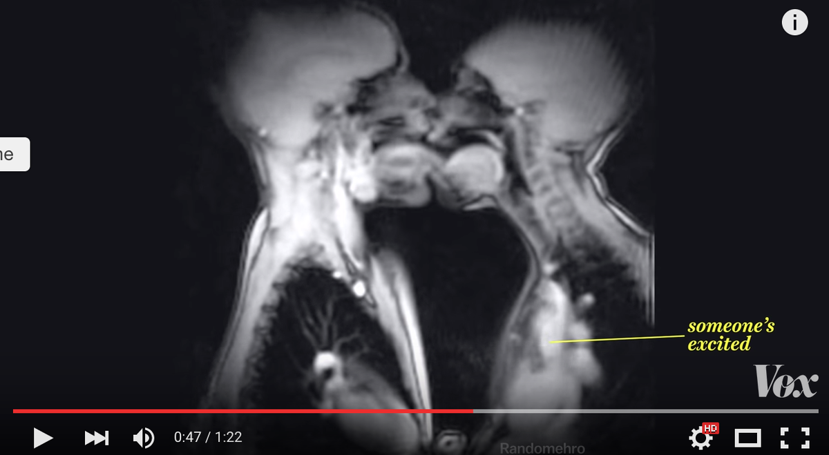 s_1115kmf's tweet photo. 【神秘動画】
MRIで撮ったセッ◯スや出産の様子がすごい
というかエ口すぎるww
動画→https://t.co/QnvgYX0LSA https://t.co/LdKK8ZEGd7