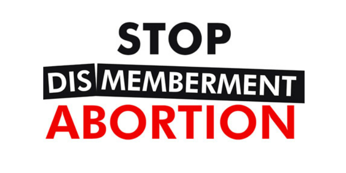 nrlc's tweet image. Appeals court: Temporary injunction remains in place against KS dismemberment abortion ban. bit.ly/1OKcvsG
