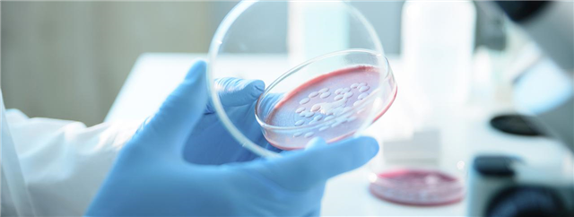 achim_pl's tweet photo. Novartis and other industry leaders call for action to address superbug threat #4patients https://t.co/Ly8bDrUSno https://t.co/MdXvQL6ZzV