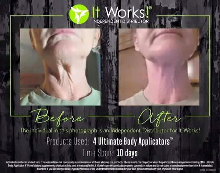 QueWrap's tweet photo. U don't need #Surgery you need #Wraps look and feel beautiful #Italy #Atlanta #NewYorkCity great gifts https://t.co/qyxNa0RKC7
