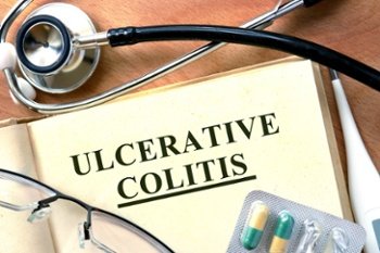 USDisability's tweet image. Am I Eligible for Disability Benefits if I have Ulcerative Colitis? hubs.ly/H01YL7z0 #GettingBenefits