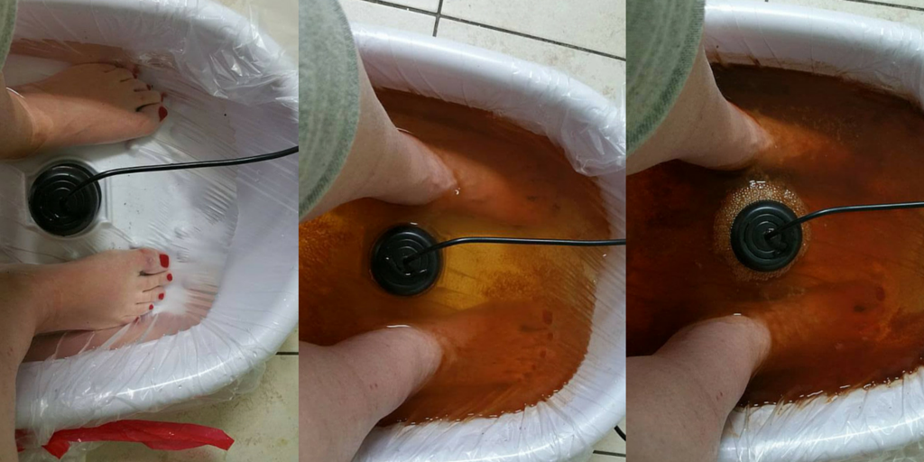 vitalityspa4u's tweet photo. #IONICDETOX $10 ONLY
#Cleanse your #body with painless fast #treatment help for removal everyday #toxins. https://t.co/7w7mFRt73g