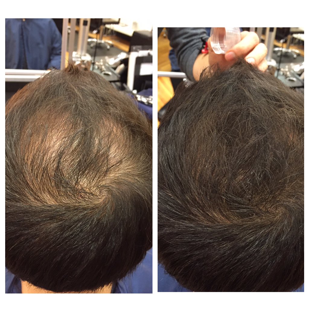 Static Hair Salon On Twitter The Miracle Toppix Amazing Https
