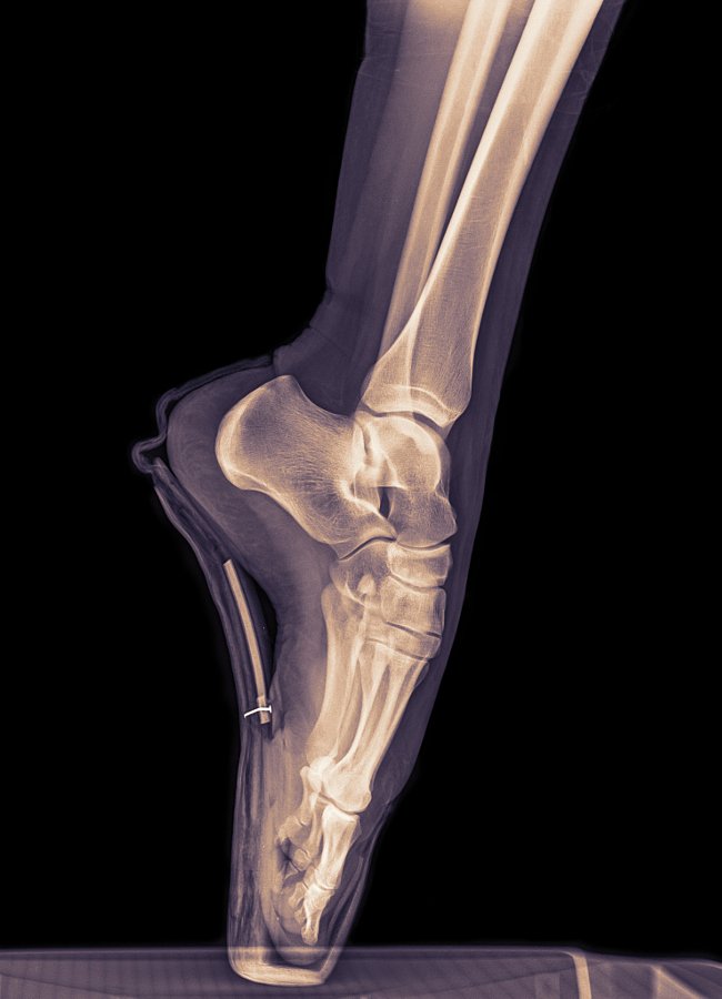 cateterdoblej's tweet photo. Así se ve con Rayos X el pie de una bailarina de ballet en acción. Imagen de https://t.co/bvrmjaJIY4 https://t.co/nXK0APxvhy