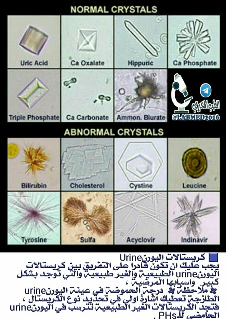 LabMed2016's tweet image. املاح اليورنurine 
#LabMed